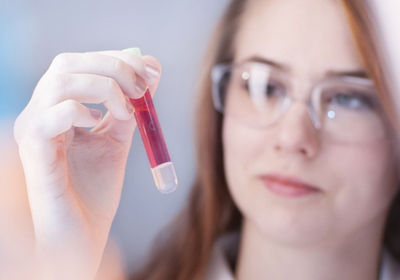 Scientists looking at blood sample 